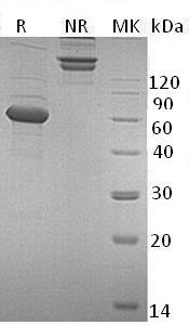 Human ULBP1/N2DL1/RAET1I (Fc tag) recombinant protein