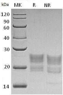 Human MPZL1/PZR/UNQ849/PRO1787 (His tag) recombinant protein