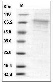 Mouse GFRA2 / GFR?2 / GDNFRB Protein (His Tag) SDS-PAGE