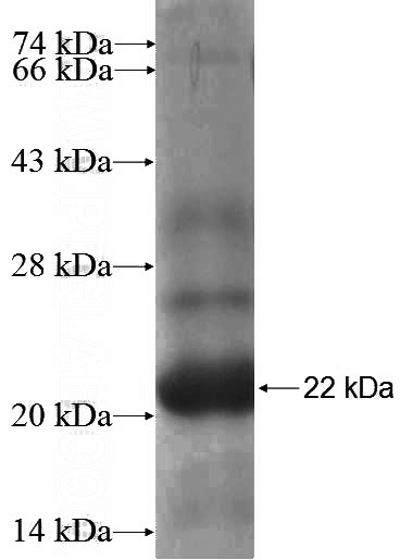 Recombinant Human ABCC4 SDS-PAGE