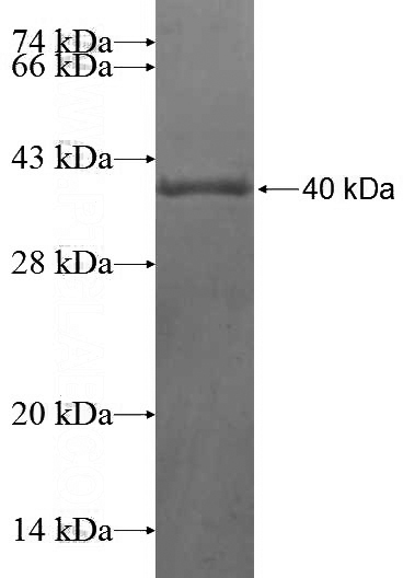 Recombinant Human DTWD1 SDS-PAGE