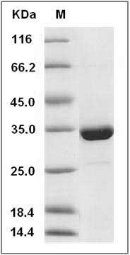 Human SULT1A3 Protein (His Tag) SDS-PAGE