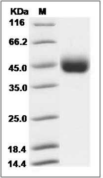 Influenza A H7N9 (A/Shanghai/1/2013) Hemagglutinin Protein (HA1 Subunit) (His Tag) SDS-PAGE
