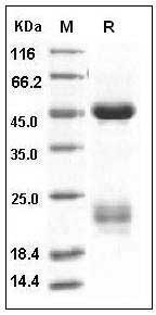Human Coagulation Factor X / FX / F10 Protein (His Tag) SDS-PAGE