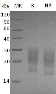 Human CSF2/GMCSF (His tag) recombinant protein