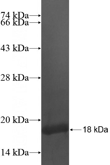 Recombinant Human LRRC3 SDS-PAGE