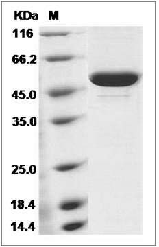 Mouse CES3 / Carboxylesterase-3 / CES1D Protein (His Tag) SDS-PAGE