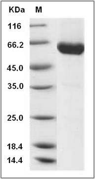 Rat Ephrin-B1 / EFNB1 Protein (Fc Tag) SDS-PAGE