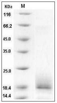 Human ALK4 / ACVR1B Protein (His Tag) SDS-PAGE