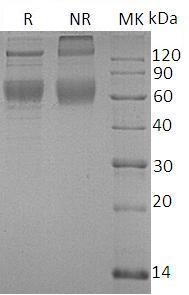 Human SERPINA4/KST/PI4 (His tag) recombinant protein