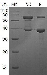 Human RBP3 (His tag) recombinant protein