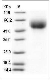 Influenza A H1N1 (A/Solomon Islands/3/2006) Hemagglutinin Protein (HA1 Subunit) (His Tag) SDS-PAGE