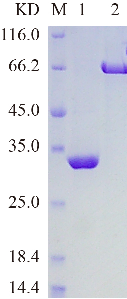 Recombinant SENP5 protein (His tag) SDS-PAGE
