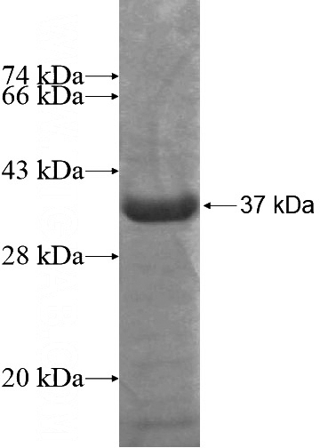 Recombinant Human FAM21C SDS-PAGE