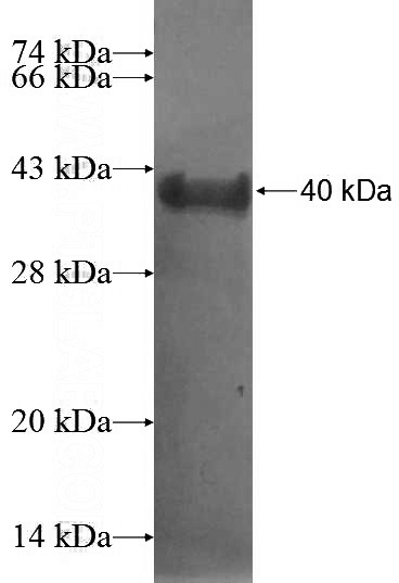 Recombinant Human C16orf62 SDS-PAGE