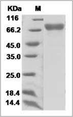 Influenza A H3N2 (A/Fujian/411/2002) Hemagglutinin / HA Protein (His Tag) SDS-PAGE