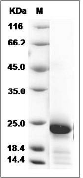 Rat IL6 / Interleukin-6 Protein SDS-PAGE