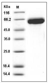 Influenza A H1N1 (A/WSN/1933) Hemagglutinin / HA Protein (His Tag) SDS-PAGE