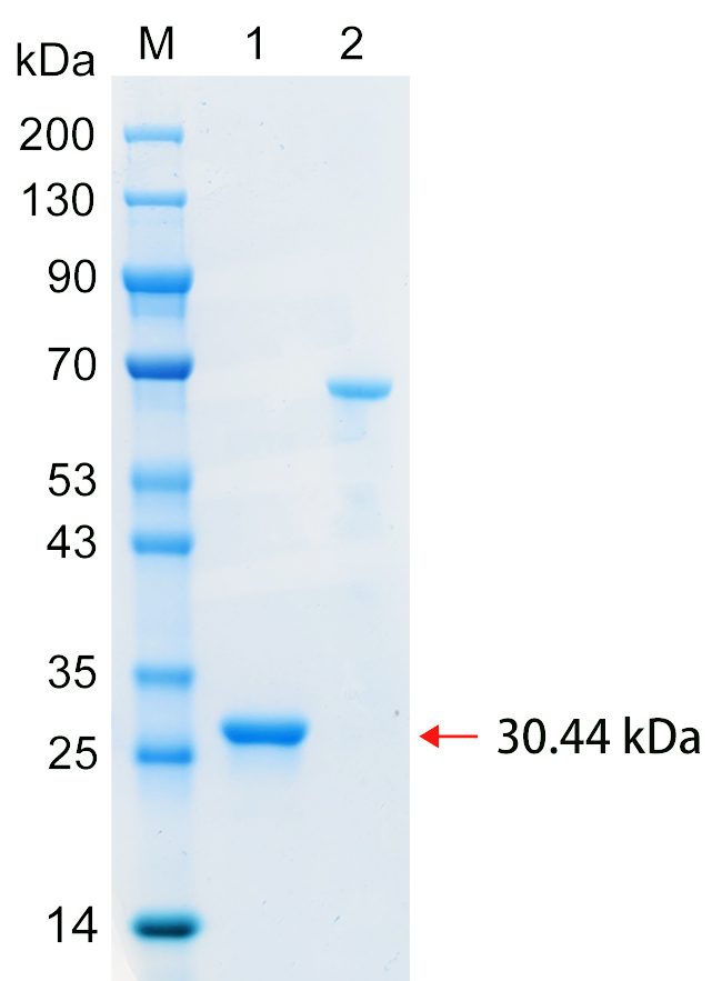 Recombinant SPC25 protein (His tag) SDS-PAGE