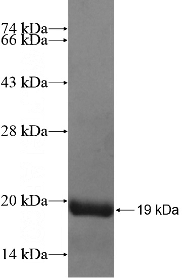 Recombinant Human ESRP2 SDS-PAGE