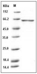 Human GAD67 / GAD1 Protein (His Tag) SDS-PAGE