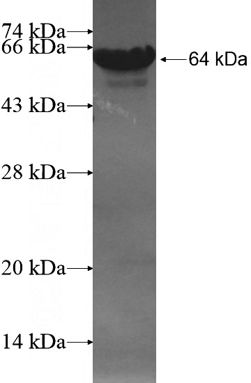 Recombinant Human PPARGC1B SDS-PAGE