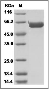 Influenza A H9N2 (A/Hong Kong/35820/2009) Hemagglutinin / HA Protein (His Tag) SDS-PAGE