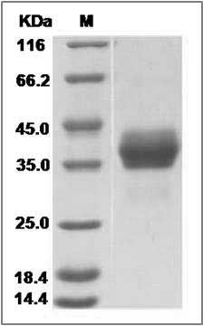 Cynomolgus EpCAM / TROP-1 / TACSTD1 Protein (His Tag) SDS-PAGE