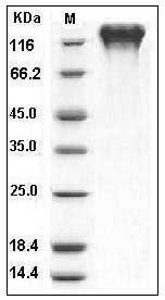Human CD50 / ICAM-3 Protein (His & Fc Tag) SDS-PAGE