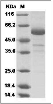 Novel coronavirus (HCoV-EMC/2012) Spike Protein fragment (aa 367-606, Fc Tag) SDS-PAGE