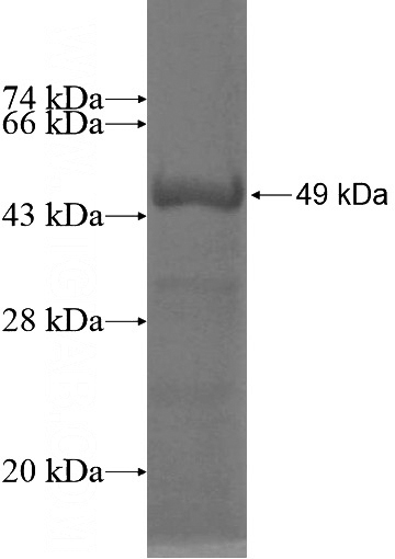 Recombinant Human PCLO SDS-PAGE