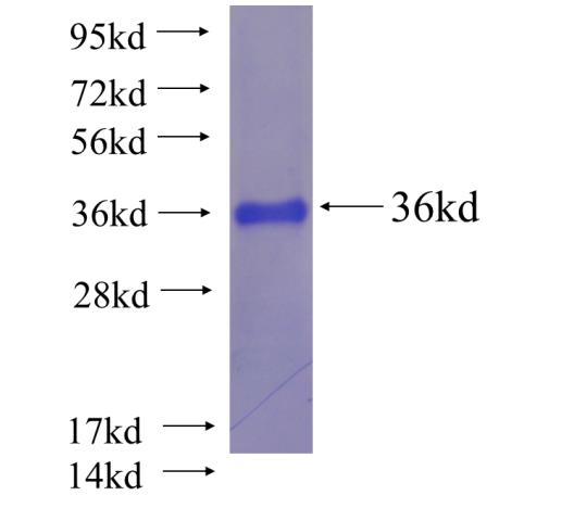 Recombinant Arabidopsis thaliana FSD2 SDS-PAGE