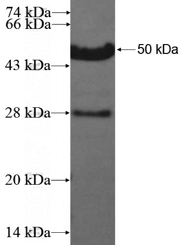 Recombinant Human IQWD1 SDS-PAGE