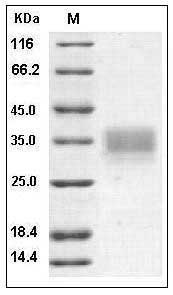 Human CD147 / EMMPRIN / Basigin Protein SDS-PAGE