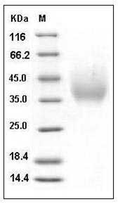 Human DMBT1 / Muclin Protein (His Tag) SDS-PAGE