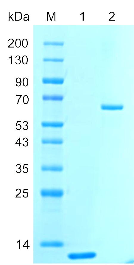 Recombinant AHSP protein (His tag) SDS-PAGE
