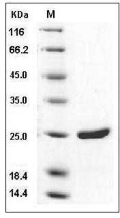 Human Immunodeficiency Virus type 1 (HIV-1) Gag-p24 Protein (His Tag) SDS-PAGE