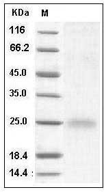 Human Cystatin 7 / CST7 Protein SDS-PAGE