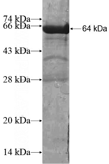 Recombinant Human AKR7A3 SDS-PAGE