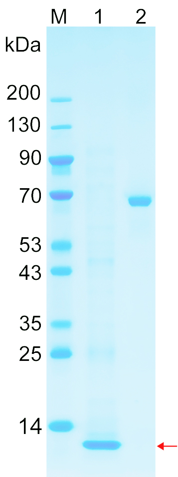 Recombinant TVB9 protein (His tag) SDS-PAGE