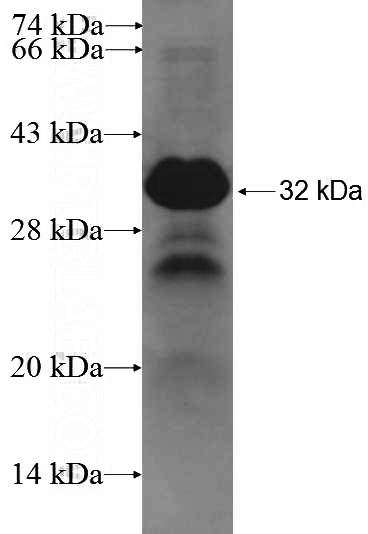 Recombinant Human C19orf26 SDS-PAGE
