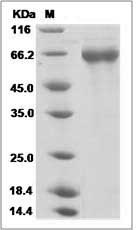 Influenza A H1N1 (A/Beijing/262/1995) Hemagglutinin / HA Protein (His Tag)