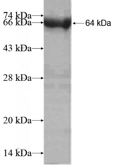 Recombinant Human TOP2A SDS-PAGE
