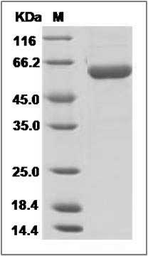 Influenza A H7N9 (A/Shanghai/4664T/2013) Hemagglutinin / HA Protein (His Tag) SDS-PAGE