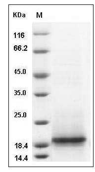 Cynomolgus CD3e / CD3 epsilon Protein (His Tag) SDS-PAGE