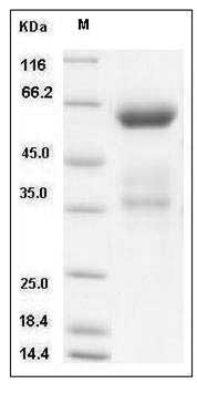 Mouse CLEC10A / MGL1 / CD301 Protein (Fc Tag) SDS-PAGE
