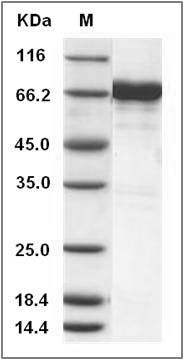 Human EphA7 / EHK3 Protein (His & GST Tag) SDS-PAGE