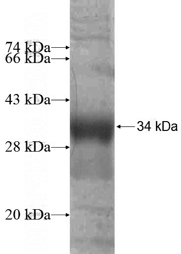 Recombinant Human GALNT12 SDS-PAGE
