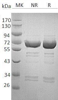 Human SERPINA12 (GST tag) recombinant protein