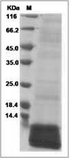 Cynomolgus / Rhesus CD81 / TAPA-1 Protein (His Tag)